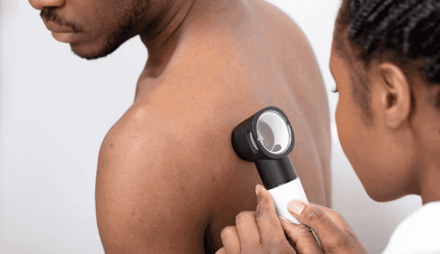 Urban-Rural Health Disparities Persist in Skin Cancer