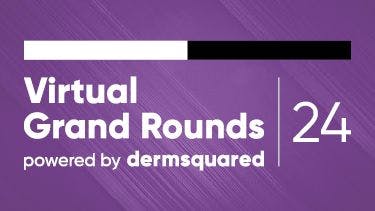 2024 Virtual Grand Rounds Session 4: March 27, 2024 - Targeting Chronic Spontaneous Urticaria: Tips on Management