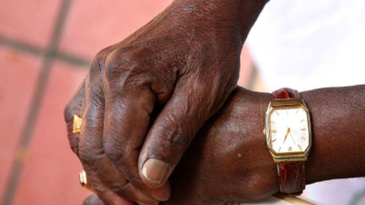 Racial Disparity Worsening in Melanoma-Specific Survival